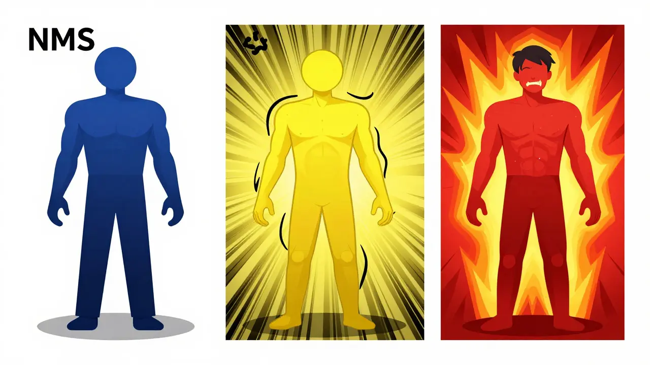 Concept art comparing muscle rigidity in NMS, Serotonin Syndrome, and Malignant Hyperthermia